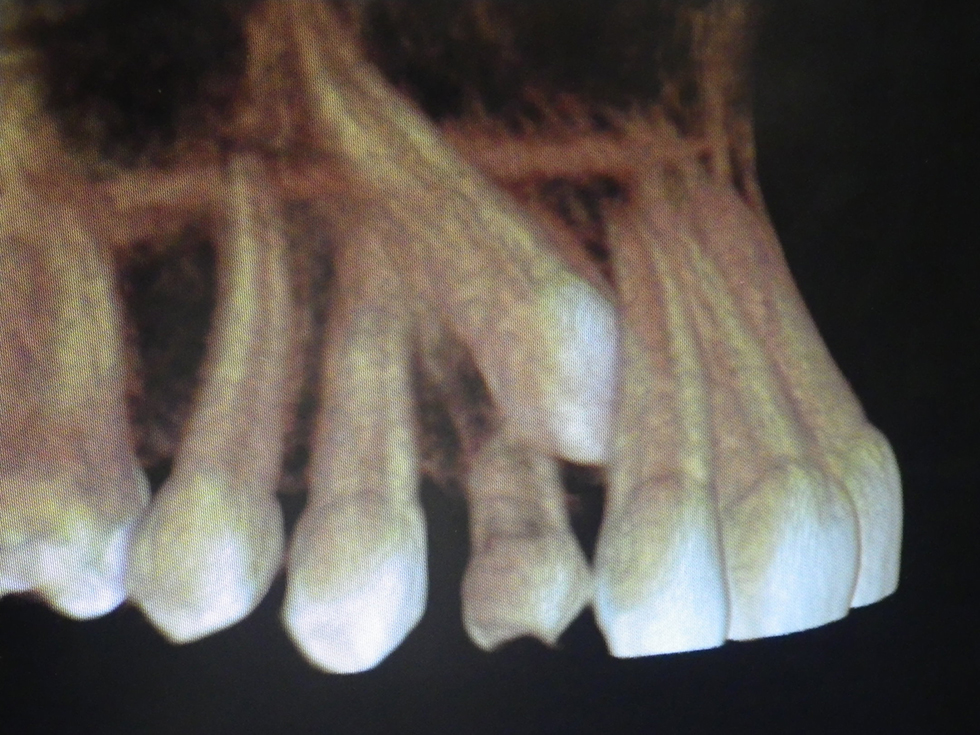 Michael-Riordan-Orthodontics-3d-xray-2