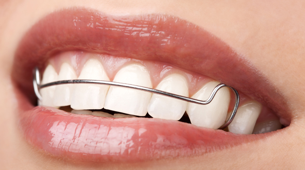 Retainer Treatment