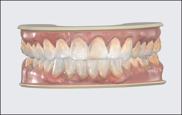 Riordan-Michael-D-DMD_3D-scanning-and-printing003